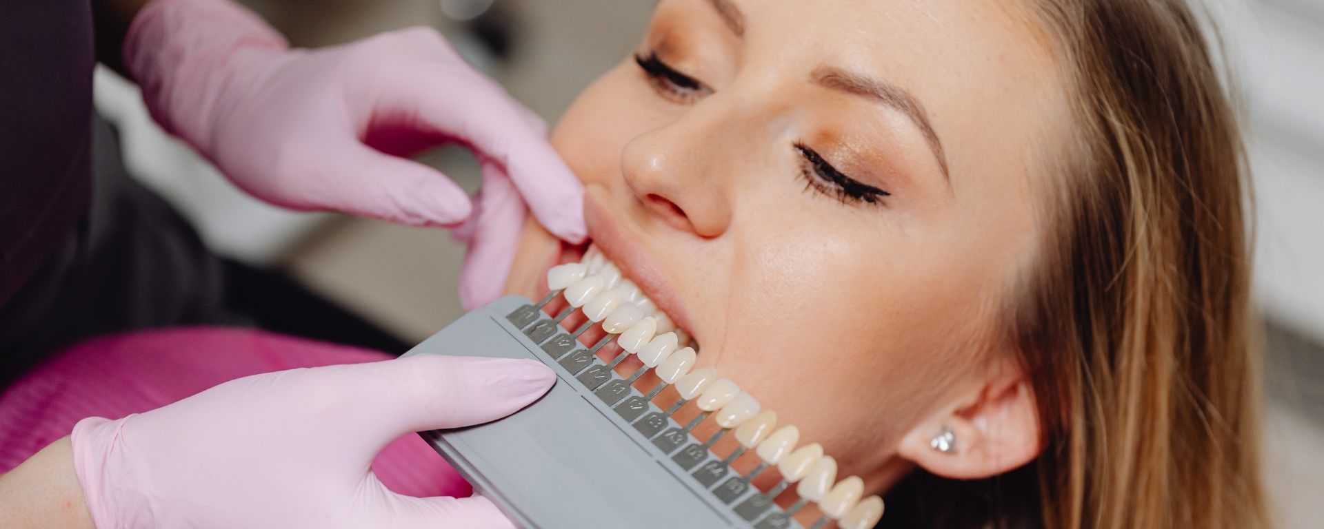 Summer Smile Package in Ferndown