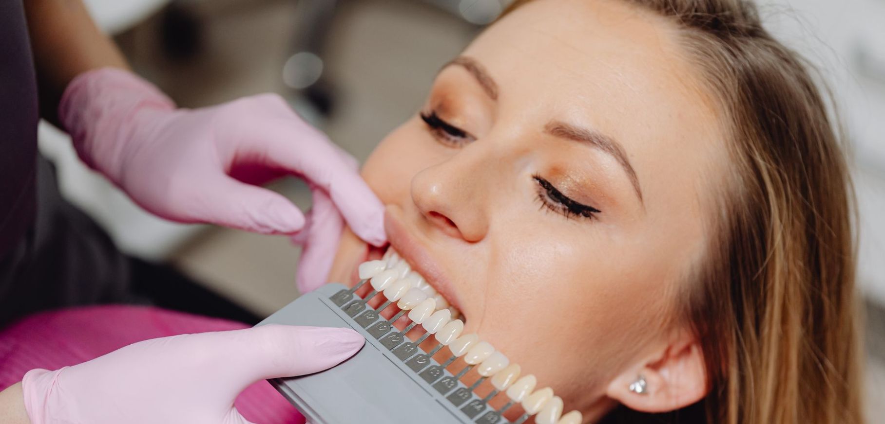 Summer Smile Package in Ferndown